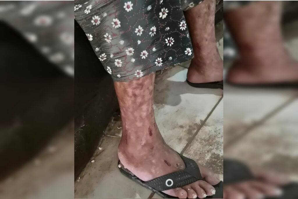 Testemunha ouviu filho que manteve mãe presa gritar: "Morre, velha"