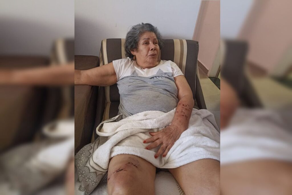 Idosa ferida por cães soltos na rua detalha ataque: “Estavam violentos”