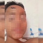 Menino de 11 anos espancado por gangue no lugar do irmão recebe alta