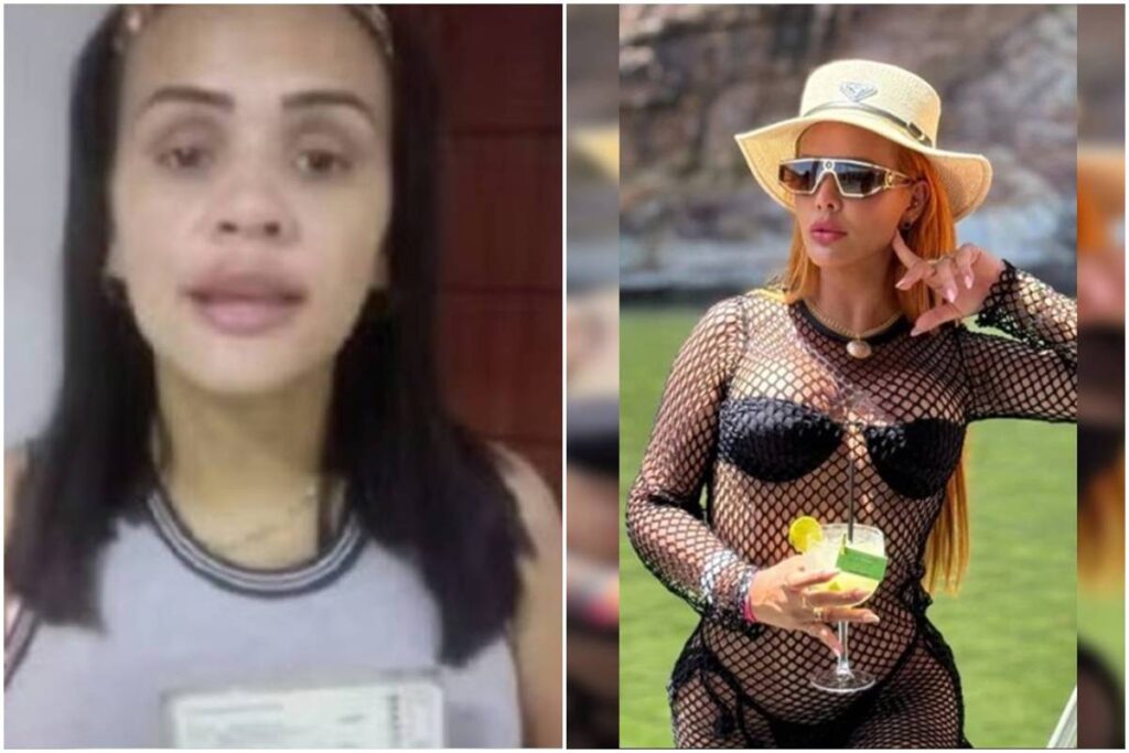 Mulher usa grana de golpe em cirurgias e "antes e depois" choca. Veja