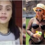Mulher usa grana de golpe em cirurgias e "antes e depois" choca. Veja